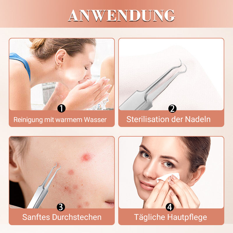 Mitesserentferner-Werkzeugset aus Edelstahl