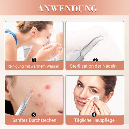 Mitesserentferner-Werkzeugset aus Edelstahl