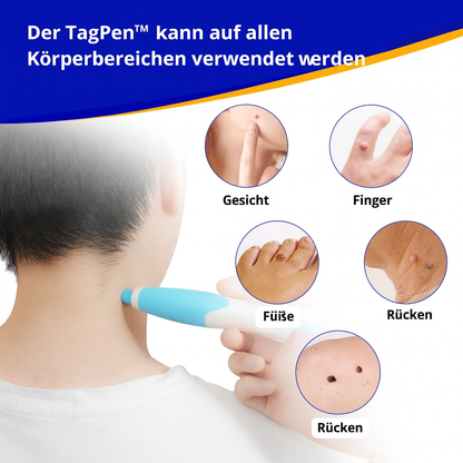 Lush TagPen Kit™ | Hautanhängsel einfach zu Hause entfernen