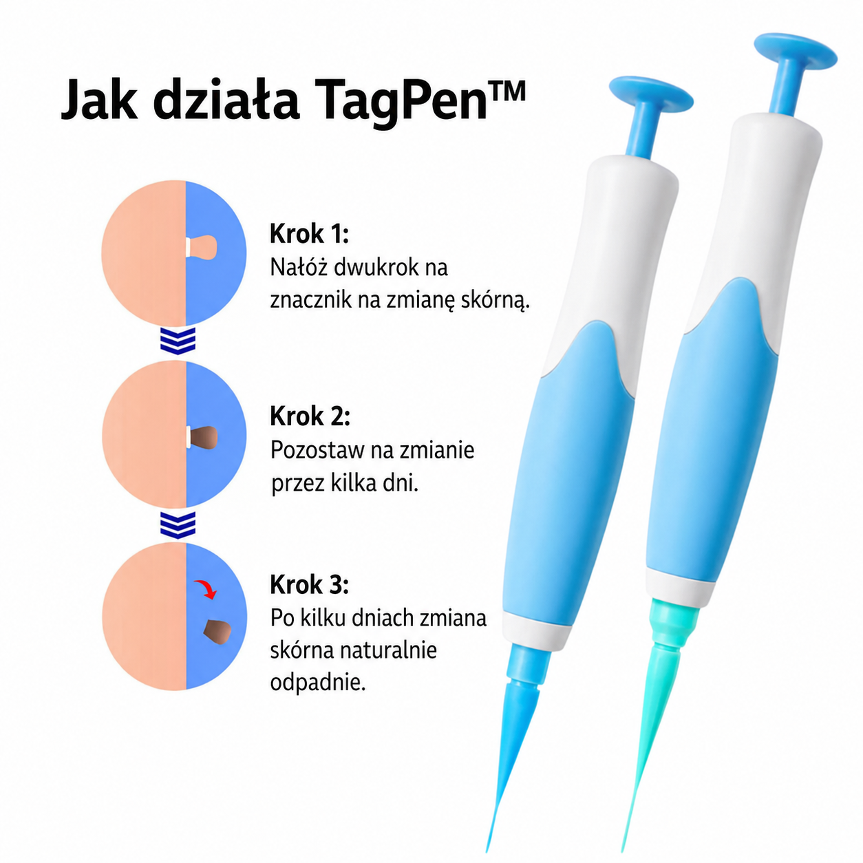 Lush TagPen Kit™ | Łatwe usuwanie włókniaków w domu