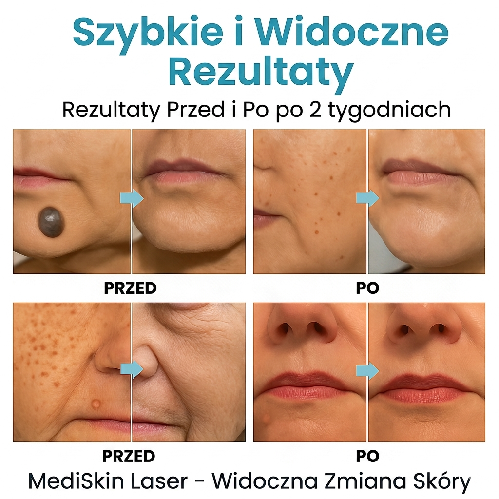 Lush MediSkin Laser | Delikatność dla Perfekcji