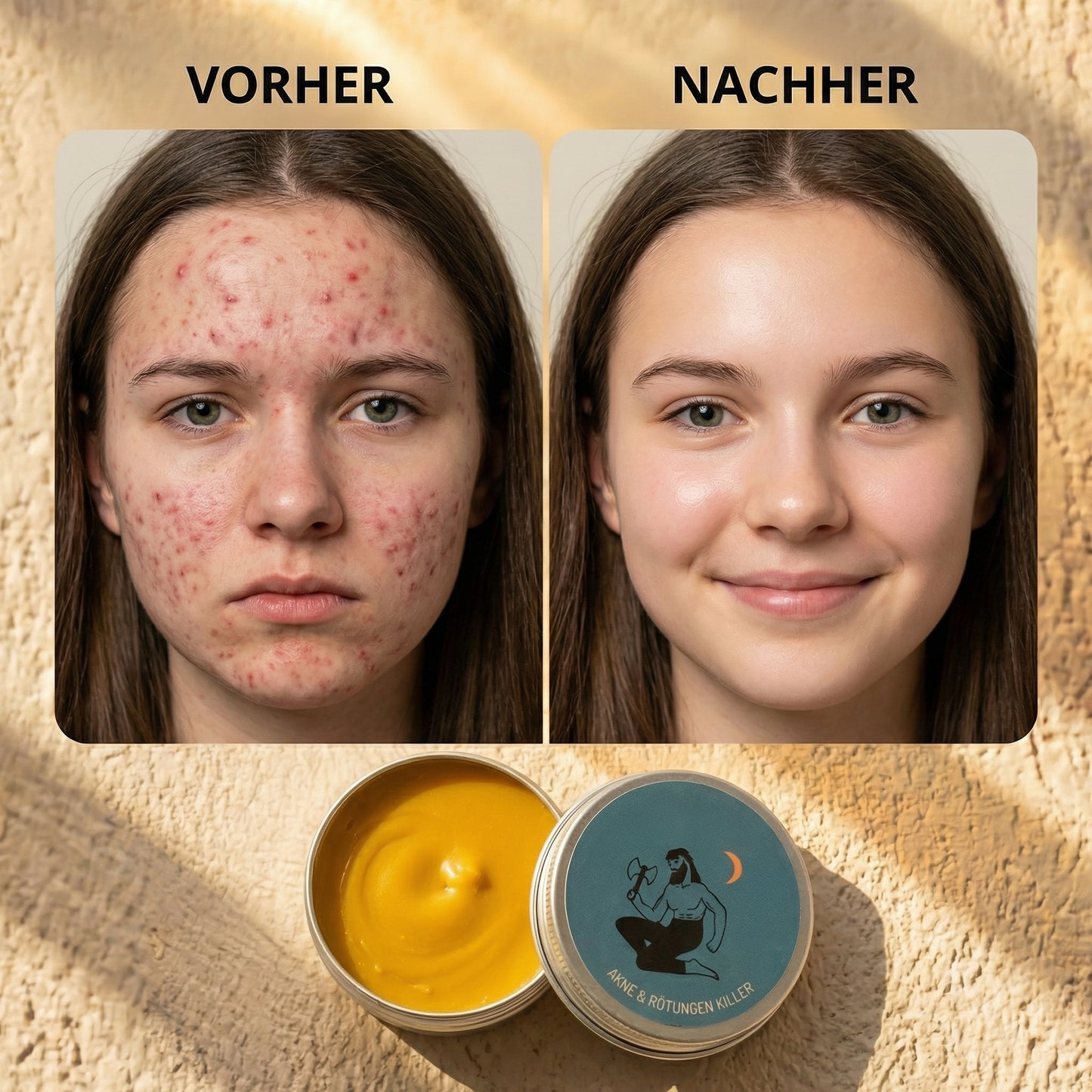 Ritual gegen Akne und Rötungen