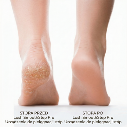 Lush SmoothStep Pro – Urządzenie do pielęgnacji stóp