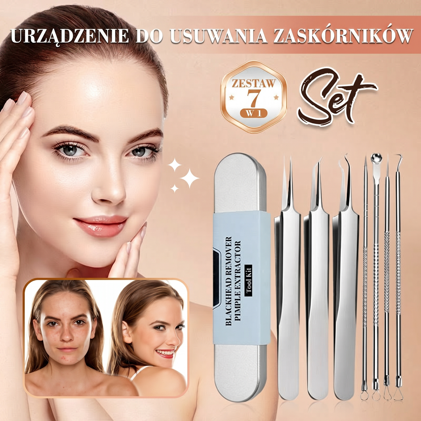 Zestaw narzędzi ze stali nierdzewnej do usuwania zaskórników