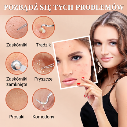 Zestaw narzędzi ze stali nierdzewnej do usuwania zaskórników