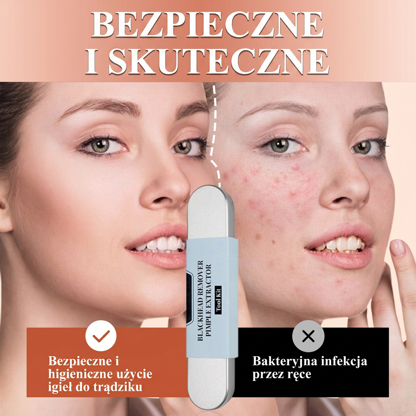 Zestaw narzędzi ze stali nierdzewnej do usuwania zaskórników